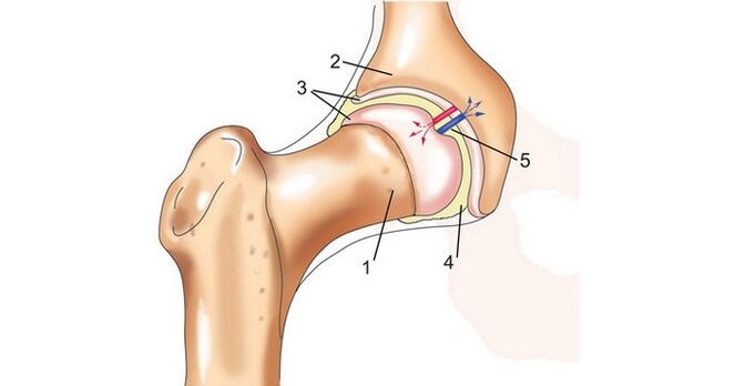 Articulación de la cadera y osteoartritis