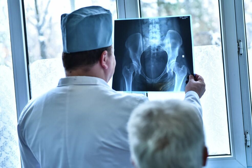 El médico observa una imagen de una articulación de cadera con osteoartritis.